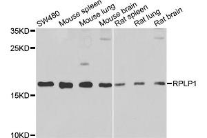 Western blot analysis of extracts of various cell lines, using RPLP1 antibody (ABIN5974064) at 1/1000 dilution. (RPLP1 antibody)