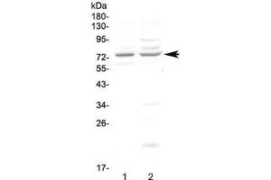 Western blot testing of human 1) COLO320 and 2) U-87 MG cell lysate with CHM antibody at 0.