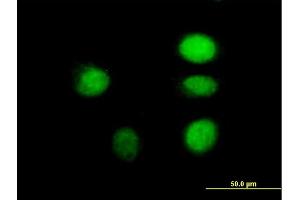 Immunofluorescence of purified MaxPab antibody to ARNT on HeLa cell. (ARNT antibody  (AA 1-789))