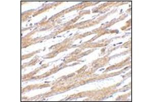 Immunohistochemistry of PDL-1 in human heart tissue with this product at 2. (PD-L1 antibody  (Center))