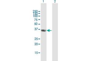 Western Blot analysis of GIPC2 expression in transfected 293T cell line by GIPC2 MaxPab polyclonal antibody. (GIPC2 antibody  (AA 1-315))