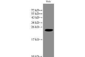 Western Blot analysis of Hela cell using IMP3 Polyclonal Antibody at dilution of 1:1000 (IMP3 antibody)