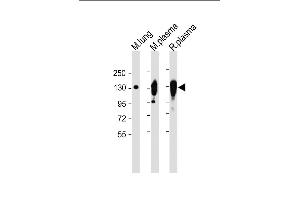 All lanes : Anti-CP Antibody (Center) at 1:2000 dilution Lane 1: Mouse lung lysate Lane 2: Mouse plasma lysate Lane 3: Rat plasma lysate Lysates/proteins at 20 μg per lane. (Ceruloplasmin antibody  (Center))