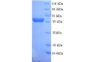 SDS-PAGE (SDS) image for Regucalcin (RGN) (AA 1-299), (full length) protein (His tag) (ABIN5713792)
