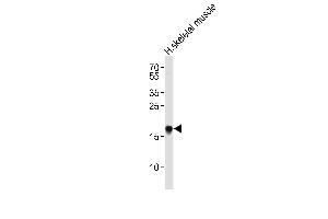 Western blot analysis of lysate from human skeletal muscle tissue lysate, using TP53INP1 Antibody (N-term) (ABIN655688 and ABIN2845147). (TP53INP1 antibody  (N-Term))