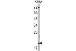 Western blot analysis of RNF5 Antibody (N-term) in K562 cell line lysates (35ug/lane).