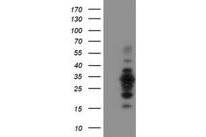 Image no. 4 for anti-MIF4G Domain Containing (MIF4GD) antibody (ABIN1499471)