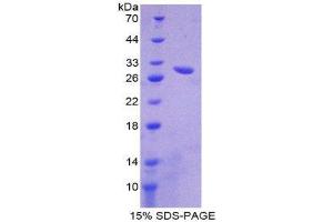 SDS-PAGE (SDS) image for ATP-Binding Cassette, Sub-Family B (MDR/TAP), Member 11 (ABCB11) (AA 420-656) protein (His tag) (ABIN2124082)