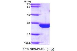 SDS-PAGE (SDS) image for Ras-Related C3 Botulinum Toxin Substrate 2 (Rho Family, Small GTP Binding Protein Rac2) (RAC2) (AA 1-189) protein (His tag) (ABIN667127) (RAC2 Protein (AA 1-189) (His tag))
