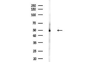 anti-Cytochrome P450, Family 21, Subfamily A, Polypeptide 2 (CYP21A2) (Internal Region) antibody
