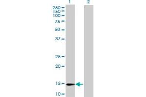 Western Blot analysis of ZNF593 expression in transfected 293T cell line by ZNF593 MaxPab polyclonal antibody. (ZNF593 antibody  (AA 1-116))