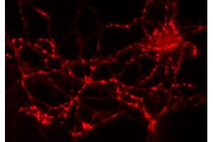 Immunolabeling of cultured hippocampus neurons (dilution 1 : 2000). (GAD65 antibody  (AA 3-96))