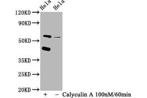Western Blot Positive WB detected in Hela whole cell lysate(treated with Calyculin A or not) All lanes Phospho-EIF2AK2 antibody at 1. (Recombinant EIF2AK2 antibody  (pThr446))