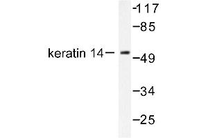 Image no. 1 for anti-Keratin 14 (KRT14) antibody (ABIN265493) (KRT14 antibody)