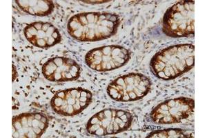 Image no. 4 for anti-Heat Shock 70kDa Protein 2 (HSPA2) (AA 1-640) antibody (ABIN598754) (HSPA2 antibody  (AA 1-640))