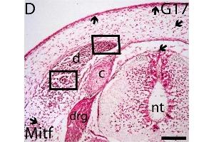 Potential migratory pathways for late neural crest cells and melanoblasts. (MITF antibody  (AA 351-450))