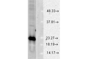 CuZn SOD Human Cell line mix 10ug WB 1 in 1000 WB.