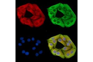 ABIN7095709 and ABIN7099771 staining Hela cells by IF/ICC. (ALAD antibody)