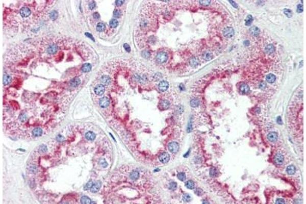 Solute Carrier Family 5 (Sodium/inositol Cotransporter), Member 11 (SLC5A11) (Internal Region) antibody