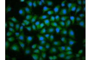 Immunofluorescence staining of Hela cells with ABIN7174438 at 1:100, counter-stained with DAPI. (UBE2D2 antibody  (AA 1-147))