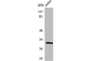 Western Blot analysis of Jurkat cells using SURF-1 Polyclonal Antibody (SURF1 antibody  (Internal Region))