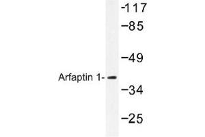 Image no. 1 for anti-ADP-Ribosylation Factor Interacting Protein 1 (ARFIP1) antibody (ABIN317818) (ARFIP1 antibody)