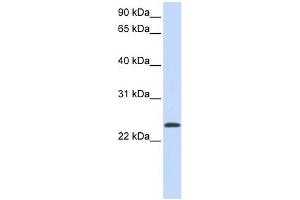 ARF1 antibody used at 1 ug/ml to detect target protein.