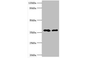 Western blot All lanes: Methylglutaconyl-CoA hydratase, mitochondrial antibody at 6 μg/mL Lane 1: Rat brain tissue Lane 2: Rat kidney tissue Secondary Goat polyclonal to rabbit IgG at 1/10000 dilution Predicted band size: 36, 33 kDa Observed band size: 36 kDa