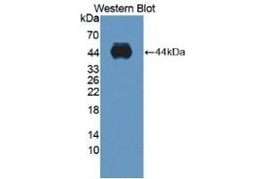 Detection of recombinant ADAMTS10 using Polyclonal Antibody to A Disintegrin And Metalloproteinase With Thrombospondin 10 (ADAMTS10) (ADAMTS10 antibody  (AA 239-602))