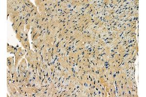 ABIN7095318 and ABIN7099375 at 1/100 staining mouse heart tissue by IHC-P. (SNX33 antibody)