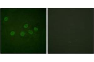 Immunofluorescence analysis of HeLa cells, using CBP (Ab-1535) Antibody.