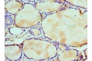 Immunohistochemistry of paraffin-embedded human thyroid tissue using ABIN7175761 at dilution of 1:100 (WDR5 antibody  (AA 1-334))
