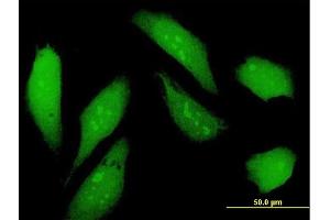 Immunofluorescence of purified MaxPab antibody to NSFL1C on HeLa cell. (NSFL1C antibody  (AA 1-370))