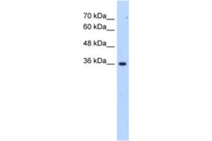 Western Blotting (WB) image for anti-Asparagine-Linked Glycosylation 1 Homolog Pseudogene (ALG1L6P) antibody (ABIN2463268) (ALG1L6P antibody)