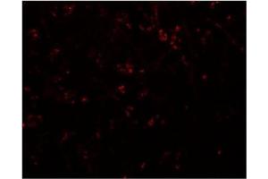 Immunofluorescence of SYNPO in human brain tissue with SYNPO Antibody  at 20 μg/ml. (SYNPO antibody  (C-Term))