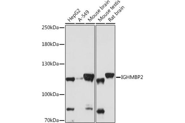 IGHMBP2 anticorps  (AA 540-720)