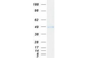 Western Blotting (WB) image for Interleukin 1 Receptor Accessory Protein (IL1RAP) (Transcript Variant 2) protein (Myc-DYKDDDDK Tag) (ABIN2723387)