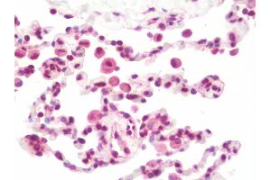 Anti-PTF1A antibody IHC staining of human lung. (PTF1A antibody  (AA 12-43))