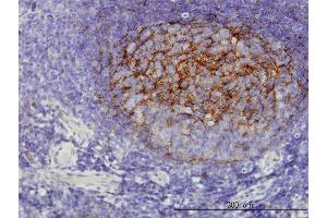 Immunoperoxidase of monoclonal antibody to QPRT on formalin-fixed paraffin-embedded human tonsil. (QPRT antibody  (AA 198-297))