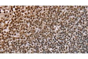 Immunohistochemistry of paraffin-embedded Human tonsil using NUP50 Polyclonal Antibody at dilution of 1:30 (NUP50 antibody)