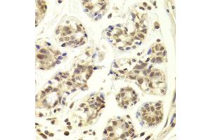 Immunohistochemistry of paraffin-embedded Human mammary gland using PRPF3 antibody at dilution of 1:100 (x400 lens). (PRPF3 antibody)