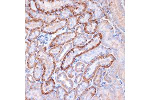 Immunohistochemistry of paraffin-embedded mouse kidney using Alpha Fodrin Rabbit mAb (ABIN7270518) at dilution of 1:100 (40x lens). (SPTAN1 antibody)