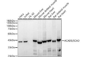 Western blot analysis of extracts of various cell lines, using ACADS/SCAD antibody (ABIN7265419) at 1:500 dilution.