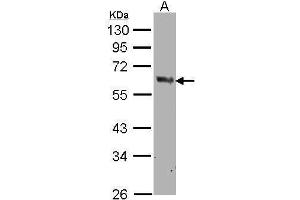 WB Image Sample(30 μg of whole cell lysate) A:MOLT4, 10% SDS PAGE antibody diluted at 1:500 (PTGS1 antibody  (C-Term))