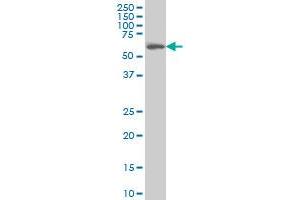 CABC1 monoclonal antibody (M04A), clone 7G1 Western Blot analysis of CABC1 expression in Hela S3 NE . (COQ8A antibody  (AA 1-100))