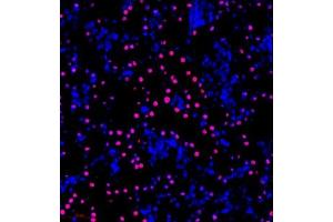 Immunofluorescence of paraffin embedded rat kidney using NPEPL1 (ABIN7073185) at dilution of 1:200 (300x lens) (BIVM antibody)