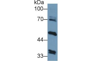 Detection of ALT2 in Human Liver lysate using Polyclonal Antibody to Alanine Aminotransferase 2 (ALT2) (GPT2 antibody  (AA 210-300))
