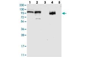 Western blot analysis of Lane 1: RT-4, Lane 2: U-251 MG, Lane 3: Human Plasma, Lane 4: Liver, Lane 5: Tonsil with RBM28 polyclonal antibody .