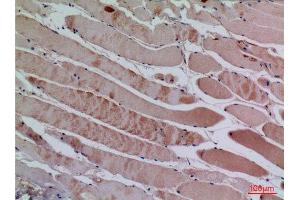 Immunohistochemistry (IHC) analysis of paraffin-embedded Human Muscle, antibody was diluted at 1:100. (CXCL13 antibody  (Internal Region))