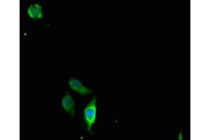 Immunofluorescent analysis of A549 cells using ABIN7147898 at dilution of 1:100 and Alexa Fluor 488-congugated AffiniPure Goat Anti-Rabbit IgG(H+L) (Claudin 2 antibody  (AA 30-230))